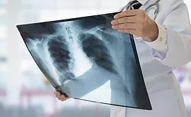 lung x-ray